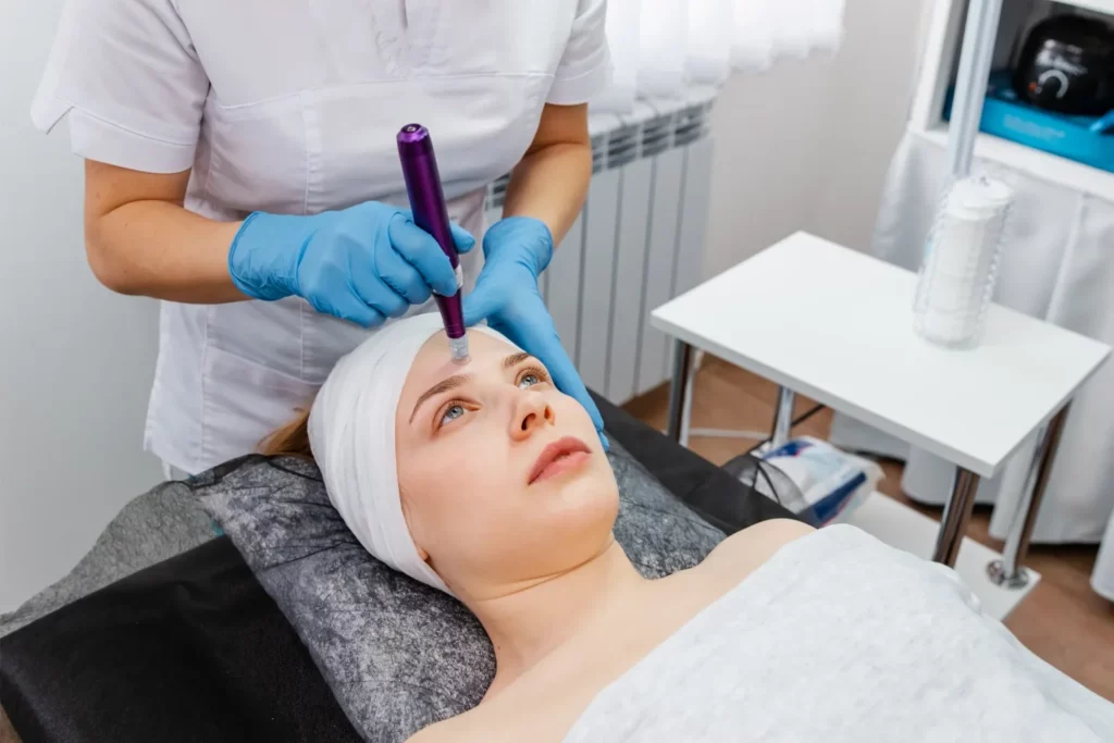 benefits of microneedling